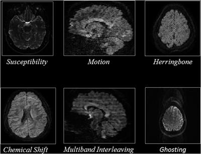 QC-Automator: Deep Learning-Based Automated Quality Control for Diffusion MR Images